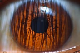 Güneş'in Kirpikleri - Görsel 1